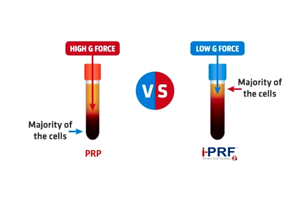 i-PRF Hair Loss Treatment at Rock Health Clinic