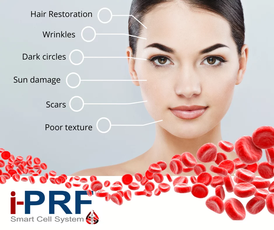 i-PRF Hair Loss Treatment at Rock Health Clinic