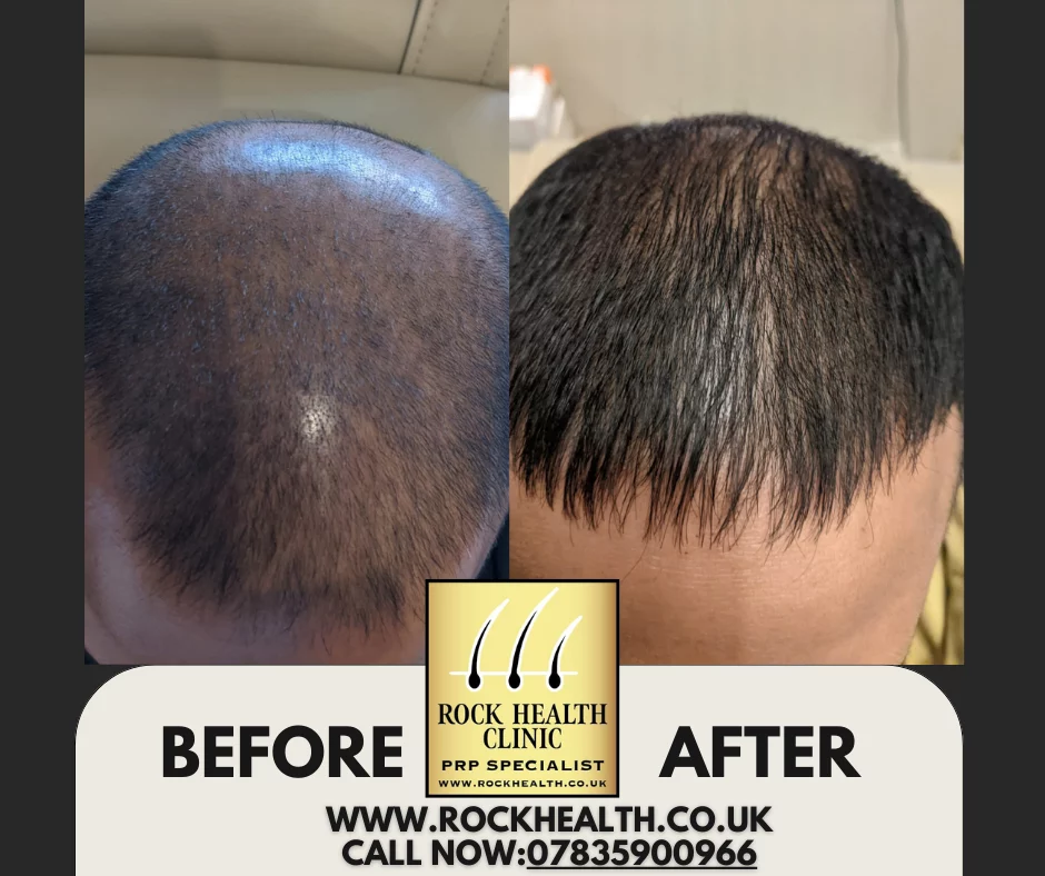 Rock Health Clinic in Birmingham