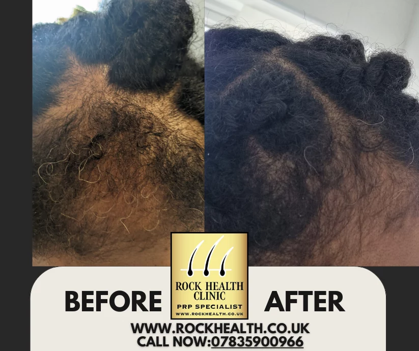 Rock Health Clinic in Birmingham