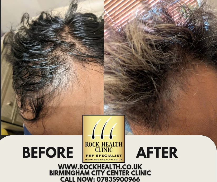 Rock Health Clinic near Birmingham New Street Station