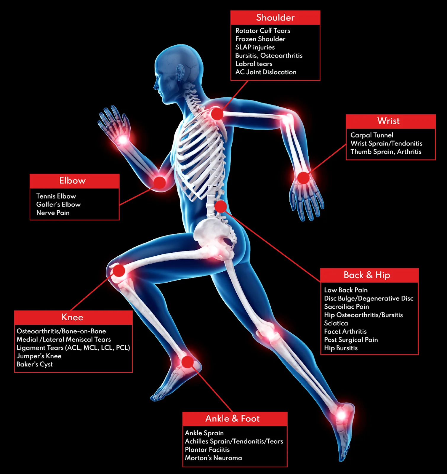 Joint pain treatment areas including shoulder, wrist, elbow, back, hip, knee and ankle