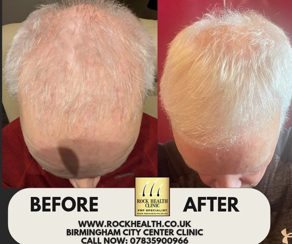 Rock Health Clinic in Birmingham