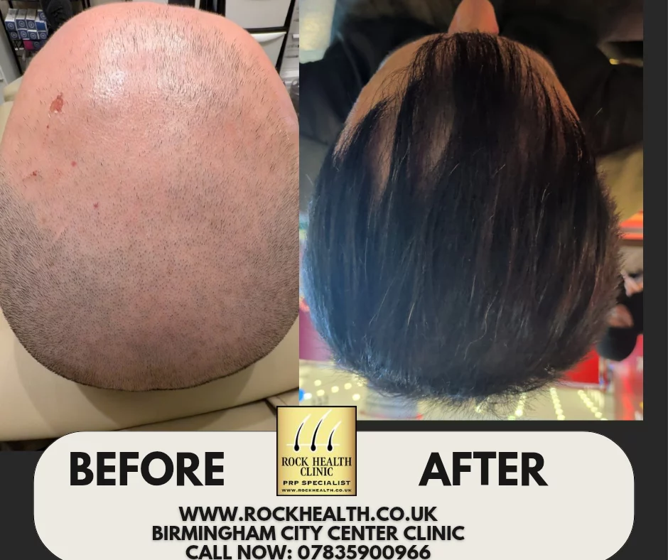 Rock Health Clinic in Birmingham